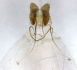 Female genitalia